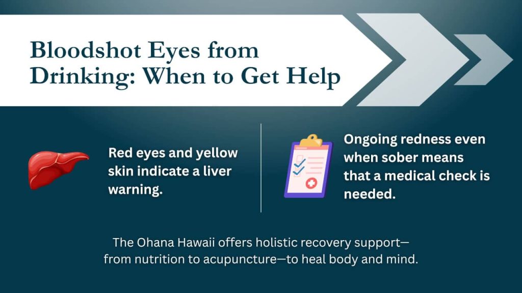 Bloodshot eyes from drinking